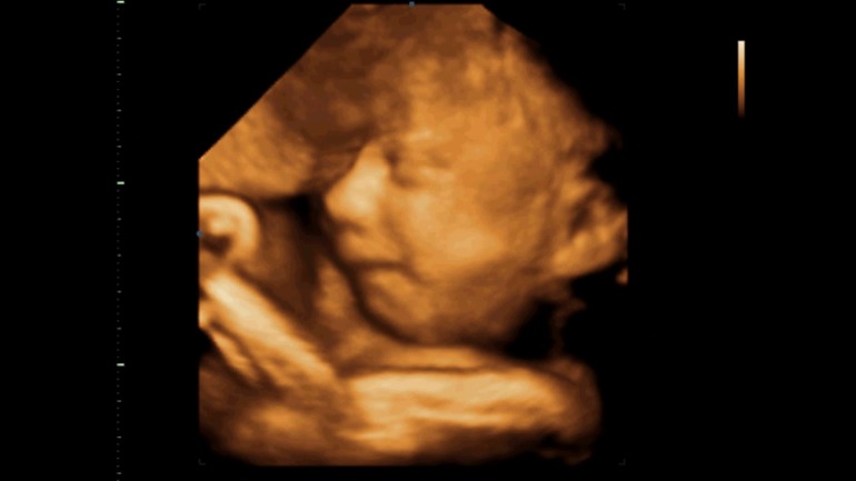 Узи, 31 неделя и 1 день.