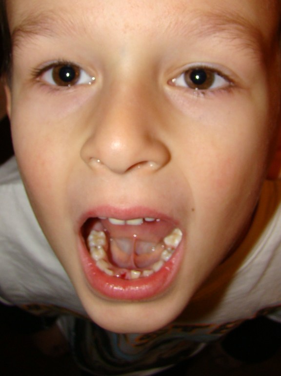 Первый молочный.