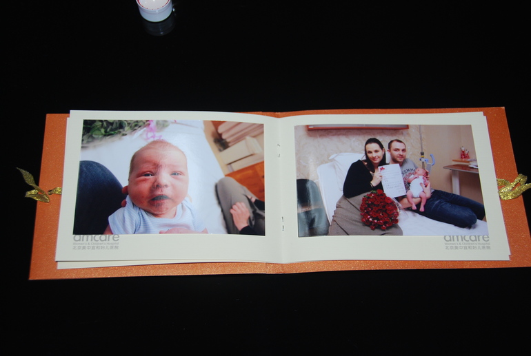 Мои роды ПКС в Китае г. Пекин