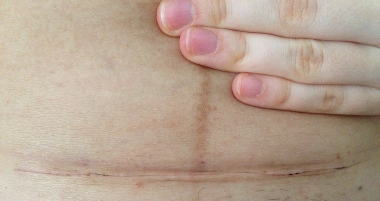 Мои роды ПКС в Китае г. Пекин