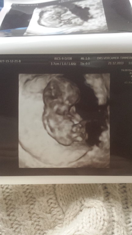 Нам 9 недель и 3 дня