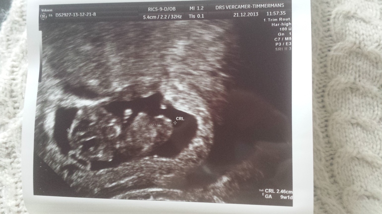 Нам 9 недель и 3 дня