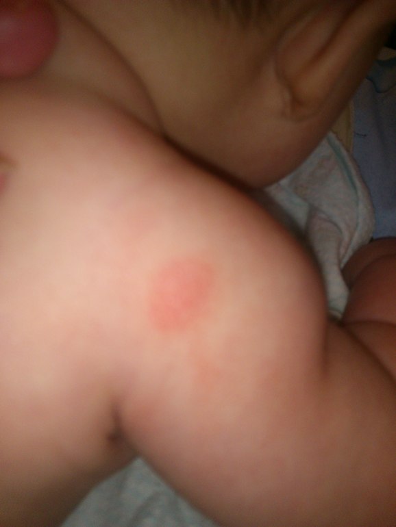 что это может быть зя пятнышко?