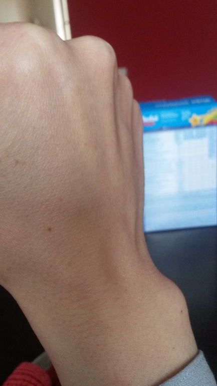 суставы на запястьях