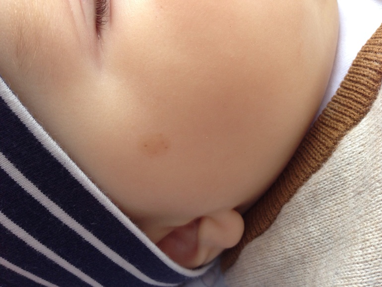 Что за пятнышки?