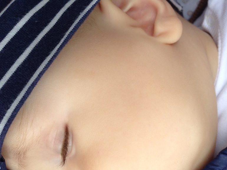 Что за пятнышки?