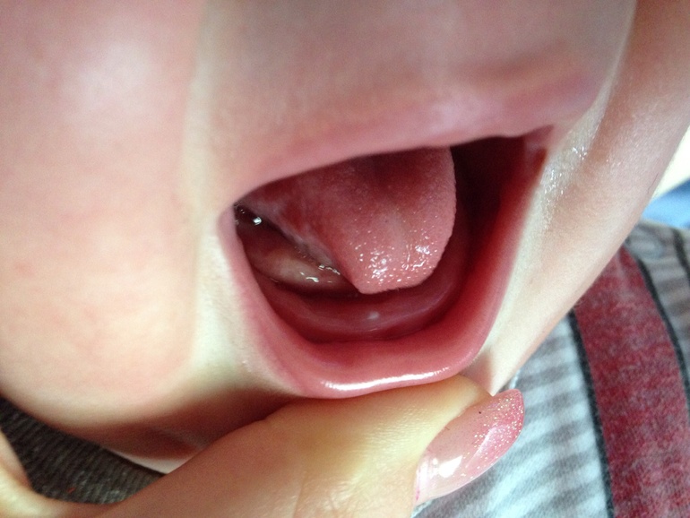 Был зуб, нет зуба (