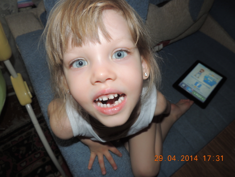 У Маришки выпал первый зуб!!!
