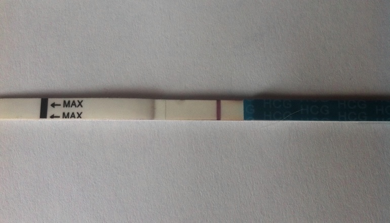 Лапороскопический цикл