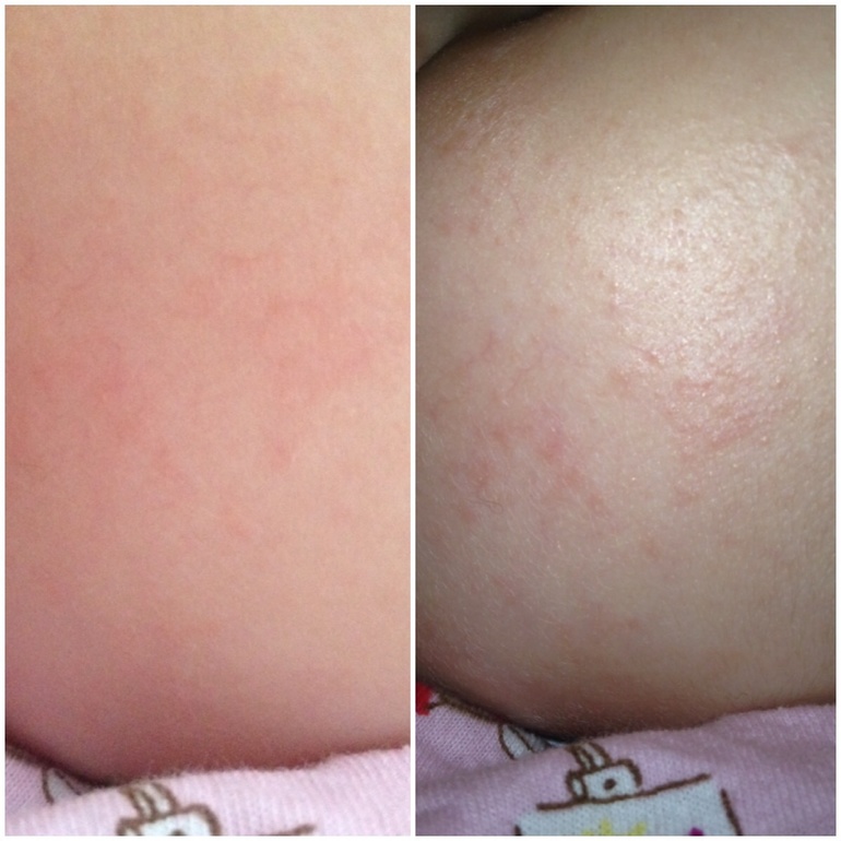 Кус Кус и Овсянка фото сыпи.