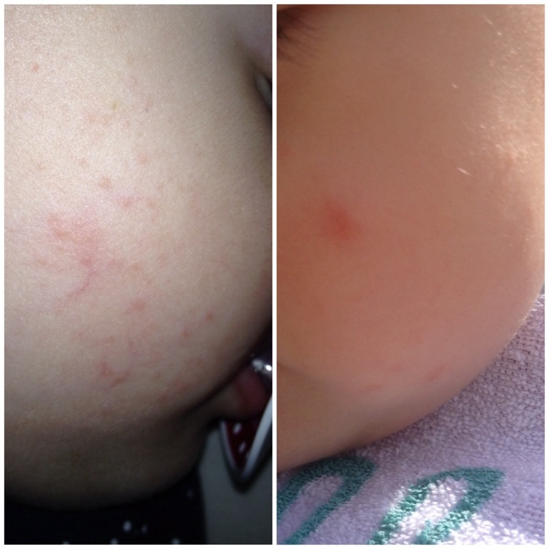 Кус Кус и Овсянка фото сыпи.